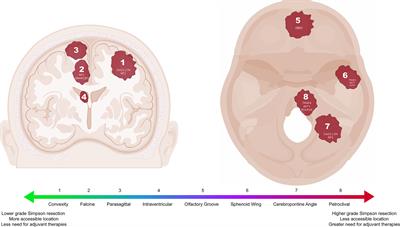 Identification and Management of Aggressive Meningiomas